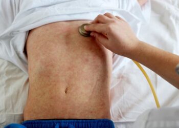 Fruthi hyn në Shqipëri, konfirmohen rastet e para në Tiranë e Durrës