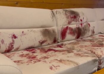 Divani dhe dyshemeja ‘larë’ me gjak, pamjet nga banesa e Eljon Hatos