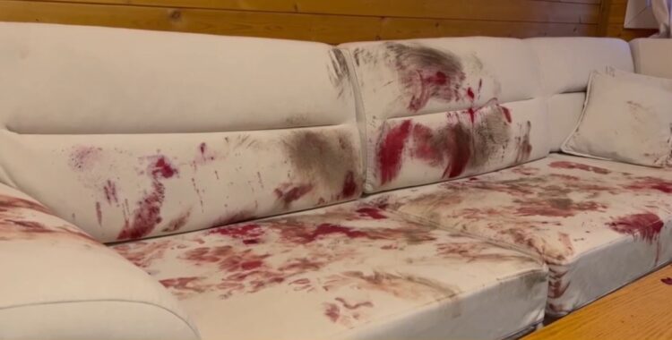 Divani dhe dyshemeja ‘larë’ me gjak, pamjet nga banesa e Eljon Hatos