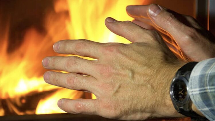 Keni lëkurë të ashpër nga i ftohti, ja si ta trajtoni