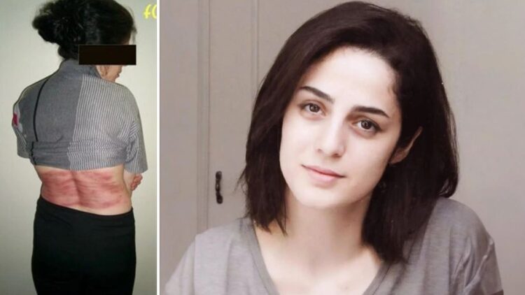 Kush është gruaja që u fshikullua 74 herë për mosmbajtje të hixhabit?