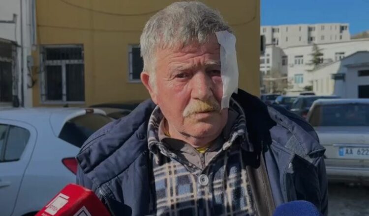 Bashkëfshatarët rrihen për pronën, njëri përfundon me plagë në kokë