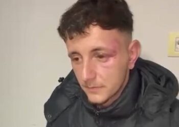 Noka me foto: Ja barbaria e policisë ndaj protestuesve të pafajshëm