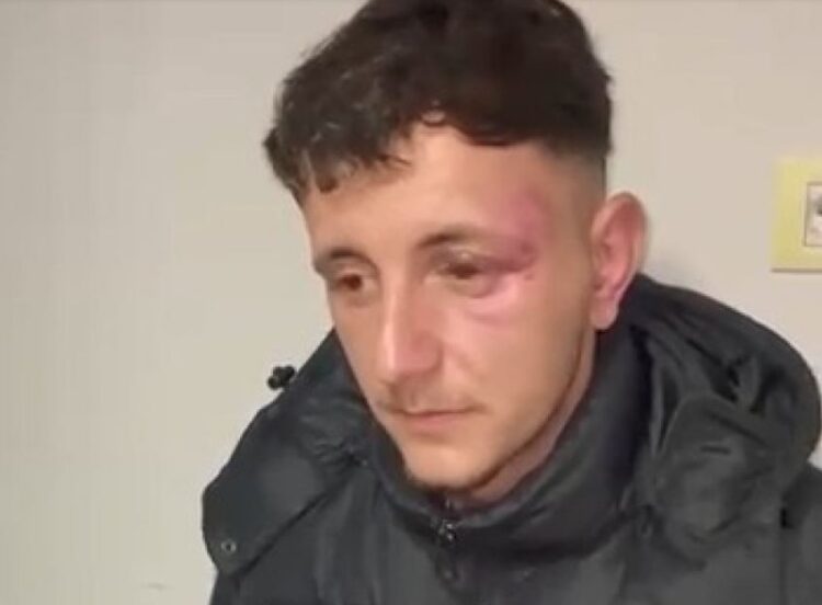 Noka me foto: Ja barbaria e policisë ndaj protestuesve të pafajshëm