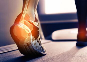 Dhimbja e kockave, si ndikon një orë ecje në javë për osteoartritin