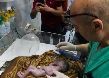 Humbet jetën “foshnja e mrekullisë”! U shpëtua nga barku i nënës së vdekur