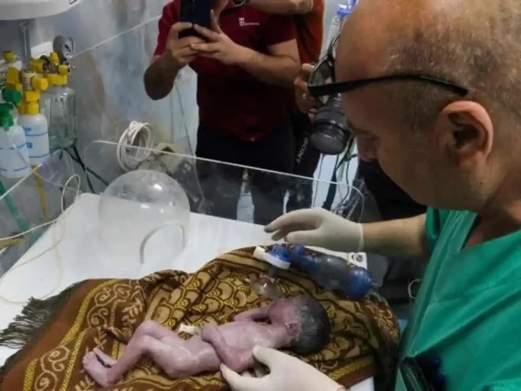 Humbet jetën “foshnja e mrekullisë”! U shpëtua nga barku i nënës së vdekur