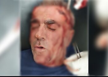 Sulmohet me zinxhir në kokë efektivi i burgut të Fierit