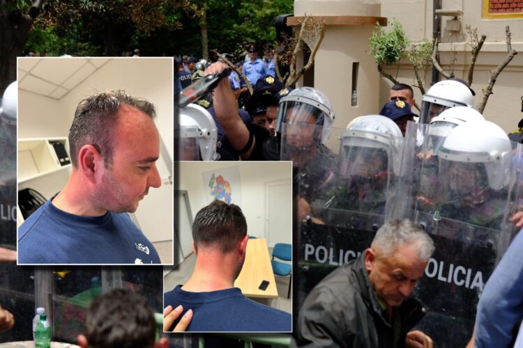 E dhunuan në protestë, Klevis Balliu nuk tërhiqet: Të degdisim zdromsin e bashkisë…