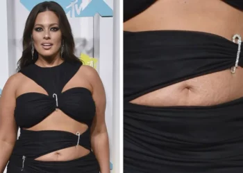 Yjet botërorë që sfiduan standartet e bukurisë, dhe treguan trupin e tyre real