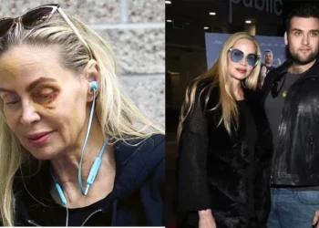 Sulmoi nënën e tij, arrestohet djali i aktorit të njohur Nicolas Cage