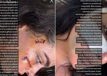 U dhunua nga motrat Berishaj/ Klea Prenga me qepje në fytyrë reagon sërish: Ajo nuk ka burrë…