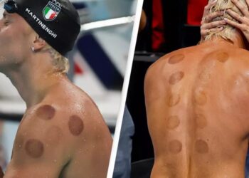 Ja përse sportistët olimpikë kanë rrathë të kuq të errët në shpinën e tyre