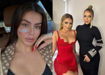 Babai i Klea Prengës: I janë dëmtuar nervat e buzës, s’është gati të flasë