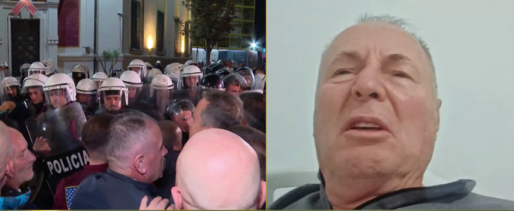 U përfshi nga flakët në protestë, flet qytetari: Kam djegie të gradës së tretë, efektivi i ra me shqelm molotovit nga unë