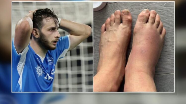 Me këmbë të enjtur, Kvaratskhelia rrezikon ndeshjen me Shqipërinë