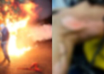 Protesta/ Pëson djegie të rënda babai i aktores shqiptare (PAMJET)