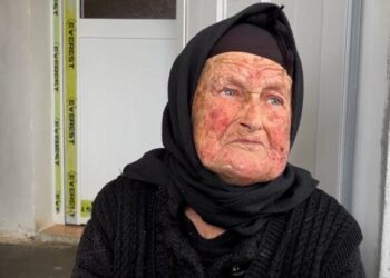 Plagosja në Fier/ Gjyshja e autorit: Nipi vuan nga probleme mendore