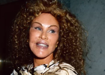 E njohur si “Catwoman” dhje për kirurgjinë ekstreme, ndahet nga jeta Jocelyn Wildenstein