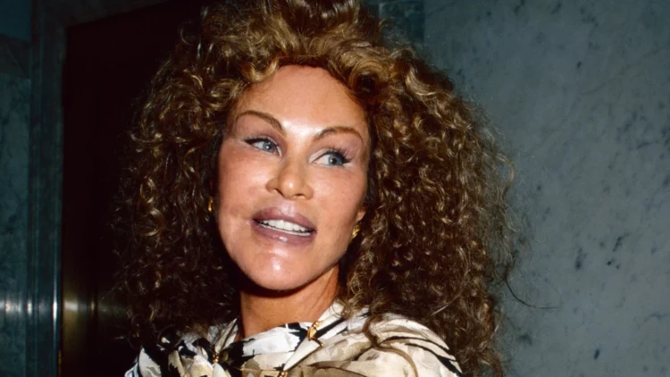 E njohur si “Catwoman” dhje për kirurgjinë ekstreme, ndahet nga jeta Jocelyn Wildenstein