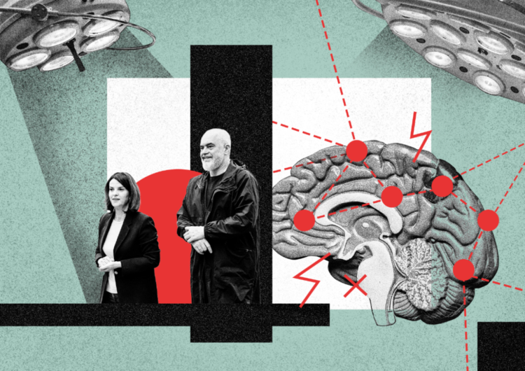 ‘Paguaj ose vdis’/ Sistemi i sëmurë shëndetësor për trajtimin e goditjeve në tru