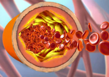Po ju e dini? Ja cila është lidhja mes tiroides dhe kolesterolit