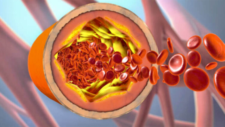 Po ju e dini? Ja cila është lidhja mes tiroides dhe kolesterolit
