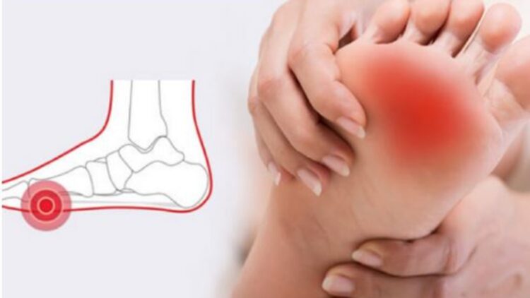 Pesë kurat më të mira për ngërçet në këmbë