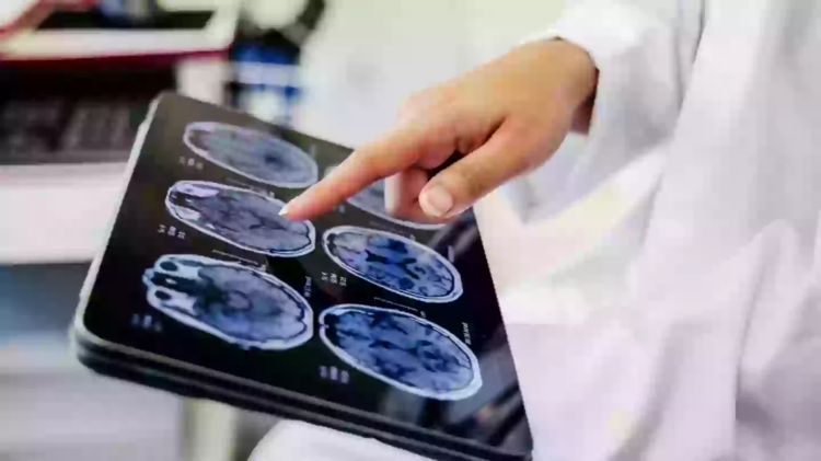 Studimi i ri: Truri i grave mund të plaket më ngadalë se ai i burrave