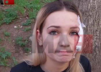 “Të gjithë nisën të vrapojnë”, e mbijetuara nga tragjedia në Koçan rrëfen tmerrin