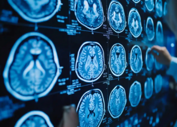 Ekspertët e Harvardit: Këto janë 4 zakonet e përditshme që përshpejtojnë tkurrjen e trurit!