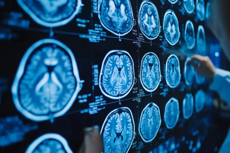 Ekspertët e Harvardit: Këto janë 4 zakonet e përditshme që përshpejtojnë tkurrjen e trurit!