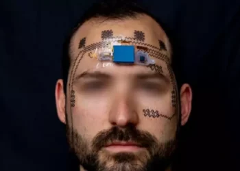 Si matet stresi mendor?