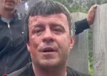 “Iku investimi 170 mijë €”/ Jeta e vështirë  e 47-vjeçari: 1 vjeç humba gjymtyrët, isha lidhur pas djepit dhe…