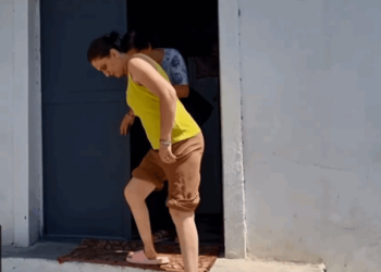 Gruaja do të presë këmbën në Itali pasi i rrezikon jetën, mjekësia në Shqipëri nuk i jep “lejen”/ VIDEO