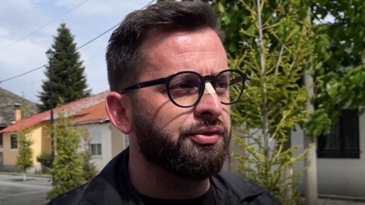 Rama shembi bujtinat në Theth/ Edhe “Çuçka” i Kolonjës nuk mbetet pas, i sulet stallës së fermerit