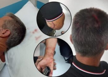 Denoncimi me FOTO/ Përfaqësuesit e “Shpërdhaza-Energji” që do ndërtojë HEC-et në Kaçinar dhunojnë brutalisht banorin e zonës