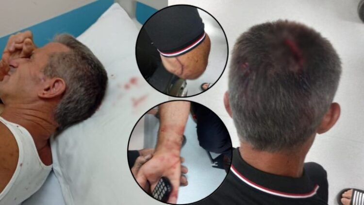 Denoncimi me FOTO/ Përfaqësuesit e “Shpërdhaza-Energji” që do ndërtojë HEC-et në Kaçinar dhunojnë brutalisht banorin e zonës