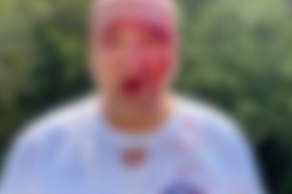 Dhunohet operatori i një guide turistike polake në Përmet/ PAMJE të rënda