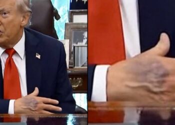 Foto/ Dora e nxirë e Donald Trump bën xhiron e rrjetit, Shtëpia e Bardhë sqaron gjendjen shëndetësore të Presidentit amerikan