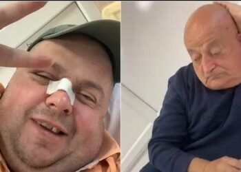 Dhunohet Genard Hajdini dhe babai i tij: Na rrahu njëri na bëri peshk