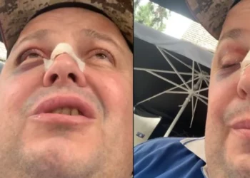 Dhunoi Genard Hajdinin së bashku me të atin, nën hetim autori dhe vajza që e shoqëronte