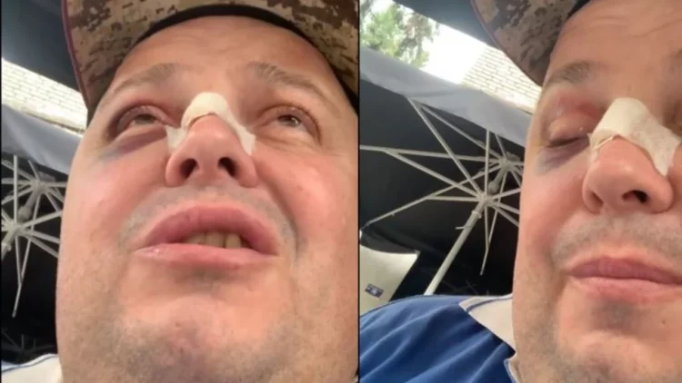 Dhunoi Genard Hajdinin së bashku me të atin, nën hetim autori dhe vajza që e shoqëronte