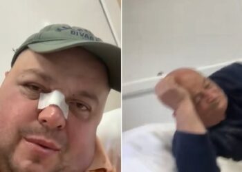 Dhunohet personazhi i njohur i rrjeteve sociale, Genardi dhe babai i tij përfundojnë te Trauma