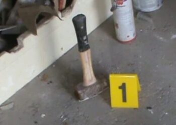 E rëndë në Vlorë/ I moshuari godet të riun me çekan në kokë, 25-vjeçari përfundon në spital