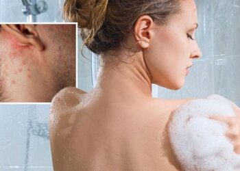 Dermatologët: Dushi i përditshëm mund të shkaktojë dëme serioze në lëkurë