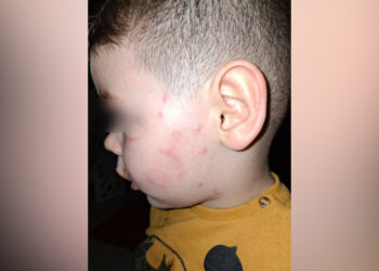 Denoncimi: Djali u dhunua në “Qendrën Siar”, dhe më pas u përjashtua