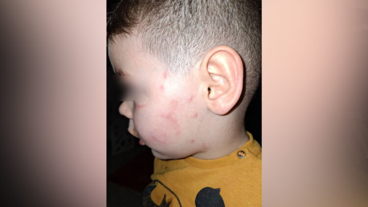 Denoncimi: Djali u dhunua në “Qendrën Siar”, dhe më pas u përjashtua