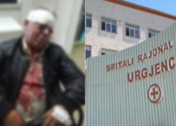 Vlorë/ Dhunohet barbarisht 70-vjeçari punonjës i pastrimit, disa orë më vonë ndalohet dy dhunuesit