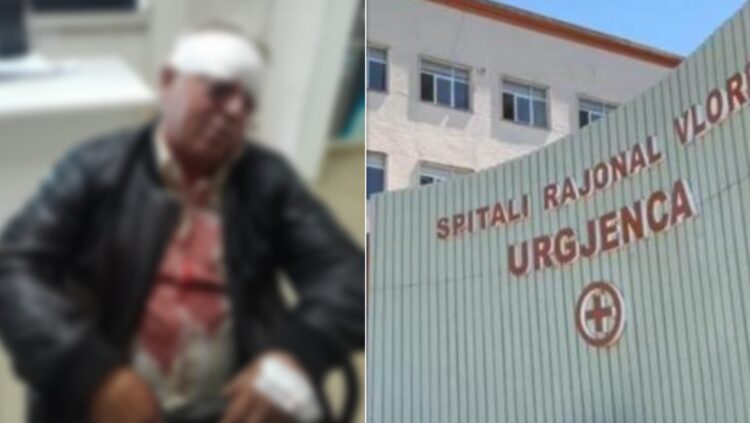 Vlorë/ Dhunohet barbarisht 70-vjeçari punonjës i pastrimit, disa orë më vonë ndalohet dy dhunuesit